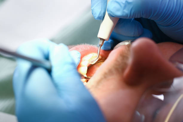 Best Emergency Dentist for Knocked-Out Tooth in Liberty Hill, TX