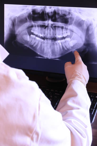 Best Emergency Dentist for Lost Fillings or Crowns in Liberty Hill, TX