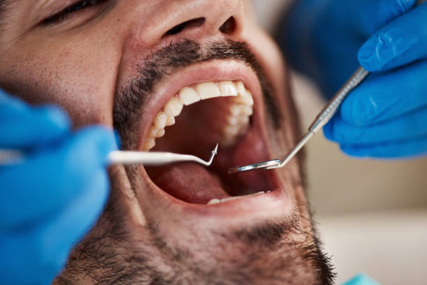 Best Orthodontic Emergency Dentist in Liberty Hill, TX