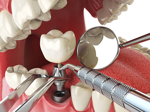 Best Holiday Emergency Dentist in Liberty Hill, TX
