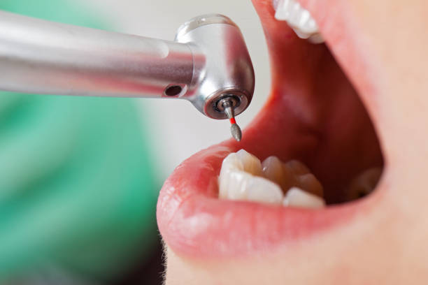 Best 24-Hour Emergency Dentist in Liberty Hill, TX